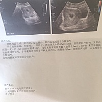 有懂的吗，麻烦给看下.怀孕8周➕了