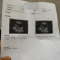 小家伙。你加油啊！别让我提心吊胆的啊！有谁知道这个是怎么回事啊！很担心，求告知