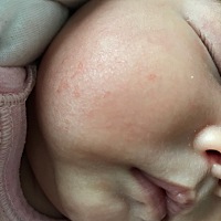 姐妹们，谁知道这是怎么了