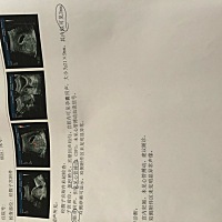 有孕囊21*9mm，似可见2mm胎芽，没有心管搏动，怎么回事？宝宝是好的吗 孩子是好的吗？