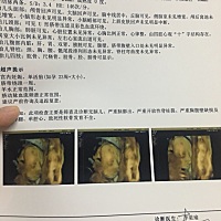 宝妈好，今天照的四维一次性通过，就是好奇是女宝还是男宝，有宝妈会看的吗？