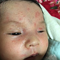 谁能告诉我宝宝脸上这个是什么呀，