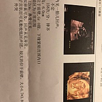 排队等的时候坐姿太过妖娆，导致拍摄环境欠佳，拍了三次才成功。建议做此检查，多走动走动，吃点东西喝...