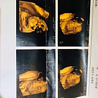 看看是小男孩还是小姑娘