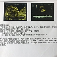 有人帮忙看看是男是女吗？另外胎心率是143