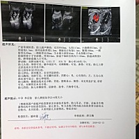 已知男女，有没有会看单子的。