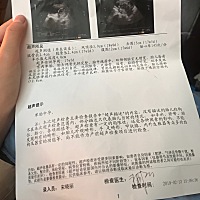 谁能帮我看一下是男娃还是女娃