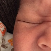 宝宝眼睛长白痘痘，这个是什么，有见过的来说说。