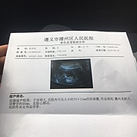 NT顺利通过，我的二宝，初次见面，愿你平安健康，粑粑麻麻期待你的到来。