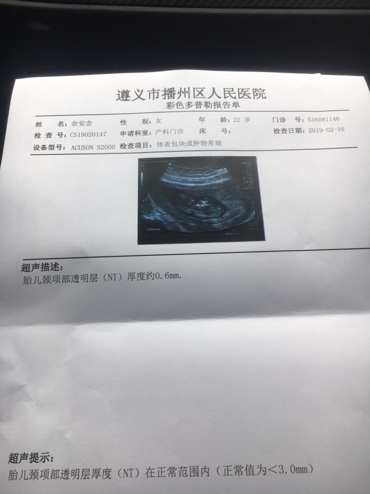 NT顺利通过，我的二宝，初次见面，愿你平安健康，粑粑麻麻期待你的到来。