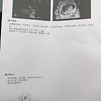 好奇心爆炸了。12周NT顺利过～能看出男宝还是女宝吗？都一样喜欢～就是好奇～好给BB准备衣服鞋袜呢🥰...