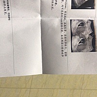 12月4日末次月经 1月14日试纸勉强测的有点像两条杠抽血hcg65 2月15b超显示 😭😭是不是没有机会了。