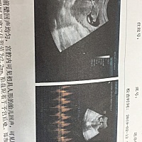 感觉这个nt做的是不是不好，小孩看着像趴着的呢，感觉一点也不清楚，要不要重新做 N