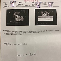 今天的检查，相对来说一切顺利，医生说偏小几天，是不是需要补补呀？有知道是佩奇还是乔治的嘛？好奇心...