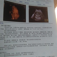 哪位宝妈有经验猜一下是男宝女宝谢谢了。