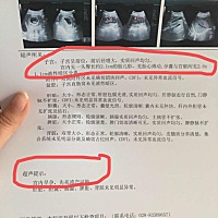 8周+5天 昨天超声检查报告显示：孕囊与宫壁间见2.6×1.1cm的液性暗区分离，有先兆流产可能。无腹痛无见...