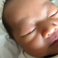 宝宝第八天 眼睛长个脓包 是什么原因