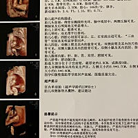 帮看下男宝还是女宝😁