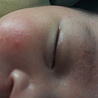 宝妈们、我们家女宝27天、脸上是什么啊？