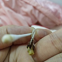 所有肚脐掉都是这样子的？