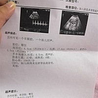 宝妈们有没有会看男宝女宝的 想提前准备宝宝的东西 谢谢啦