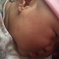 这是湿疹吗？用什么牌子的药膏效果好呢！！