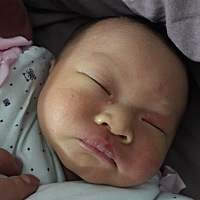 宝宝脸上这个红颗粒和眼角边上的痘痘是怎么回事，都一个星期了也没见消掉，有没有宝妈知道的