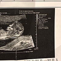 有懂的怎么看性别的么，麻烦帮忙看下