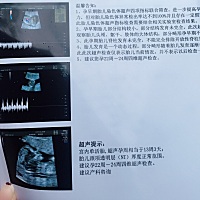 nt顺利通过喽！