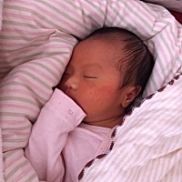 宝贝第九天，刚出生给穿的太厚了加上开暖气，宝宝脸颊起了很多热疹子，最近穿的少了，脸上基本不再长新...