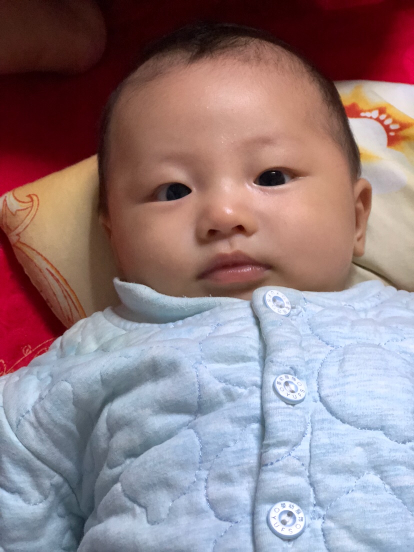 一个多月了黄疸还没退的时候真的丑不啦啦啦了，