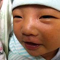黄疸一个月没有退，现在两个半月了，皮肤白白的嫩嫩的没有任何瑕疵，就感觉真的好。 一个多月了黄疸还没...