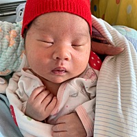 宝妈们你们有这种情况的吗？我家宝宝额头 鼻子下方都有红色的印记 感觉一个月了也没有变淡！好担心啊