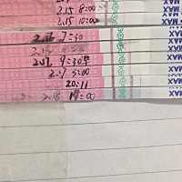 为什么现在右下腹好痛啊……
