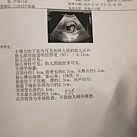 NT顺利通过，但愿是，小棉袄