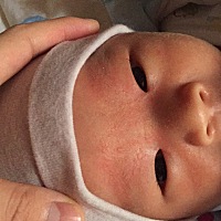 有宝妈知道我家宝宝这是长得什么吗？生下来没有，过了十天左右眉毛两边长了一些，现在整个眉毛眼睛周围...