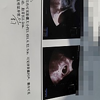 虽然她还很小，但很好奇是男宝女宝