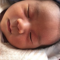 今天13天脸上这个是什么