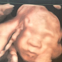 男孩还是女孩啊 太丑啦😂怎么这么丑 哈哈哈哈