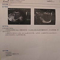 有没有宝妈知道检测结果后面两项是什么意思，有什么影响吗？