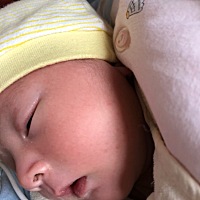 宝妈们，你们知道我崽脸上长的什么吗？今天发现的，两边都有，眉毛上也有点。问了婆婆说没事。是不是热...