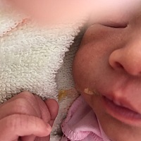 有宝妈知道宝宝吐奶，是黄色的，跟蛋花汤似的，是怎么回事吗？医生说怕是羊水感染，查了血常规等也没事...