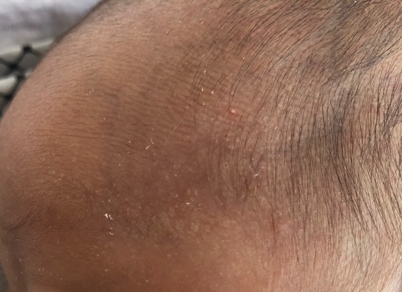 这是长了什么嘛？求解🙏🙏