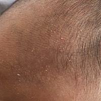 这是长了什么嘛？求解🙏🙏