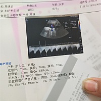 想知道是不是女宝♥