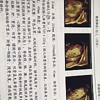 各位准妈妈们，有没有预产期是5月22日的猪宝宝，附一张四维照片，能看出男孩女孩吗