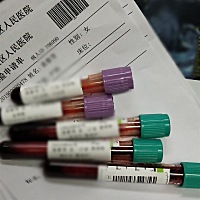 四维彩超延迟一个星期有影响吗？医生叫我去预约四维，可是彩超室的护士说排满了，必须延迟一个星期..…...