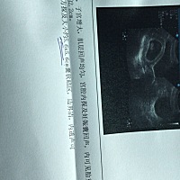 怀孕9周，有囊块，怎么办，