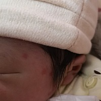 宝妈们。宝宝脸上长这个红点点是怎么了呀？今天才长的。新手妈妈，我真的不知道这是怎么了，有知道的宝...
