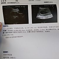 帮忙看看怎么回事